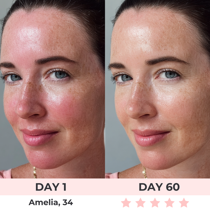 LumeLift™ - LED Face Mask