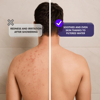 HydraPure™ - The Filtered Showerhead